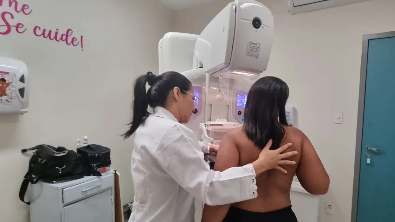 20251220 MAMOGRAFIA SITE