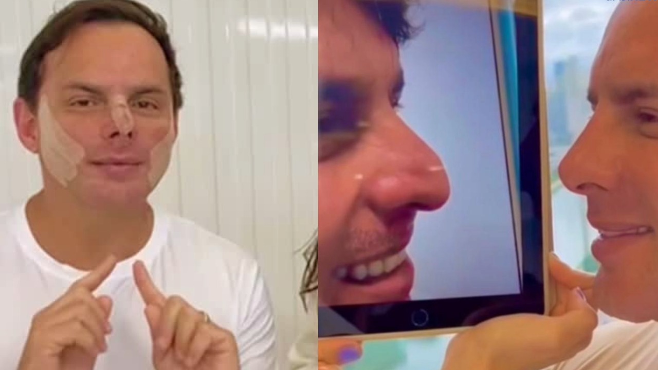 Marido de Gretchen mostra antes e depois de procedimentos estéticos no rosto e web reage: ‘Vai na onda dela’