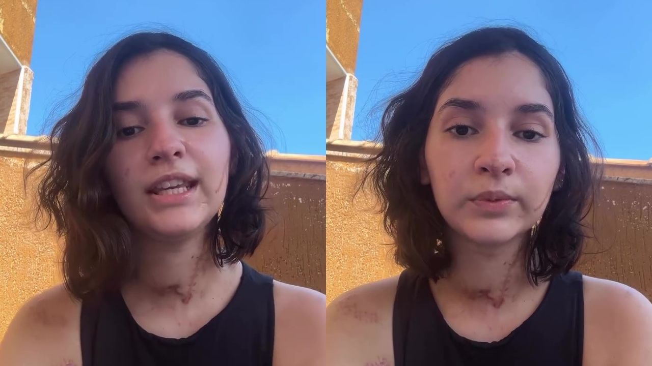 Alana Rosa, agredida após recusar pedido de namoro, fala pela primeira vez sobre o caso