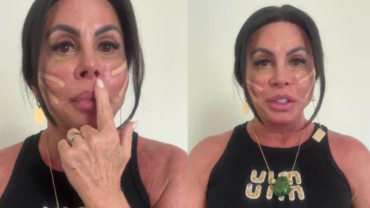 Gretchen mostra novo procedimento estético e fala em corpo sem flacidez aos 67 anos